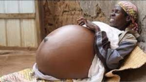Amaze imyaka itanu(5) atwite inda itavuka|abaganga bamubwiye amagambo akomeye ,Ntazi ikiri mu nda ye BIRABABAJE.