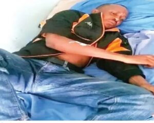 Umugabo arembeye mu bitaro nyuma yo gukubitwa n’umugore we amuhora ko yanze gusinya ngo batandukane