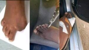Umugabo wavuze ko muri Zimbabwe hari isoko ry’amano y’abantu ari mu mazi abira.