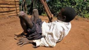 Amaze imyaka 30 Agendesha Umugongo | Abarozi nibo babikoze | Burya koko satani abaho turabyiboneye pe!