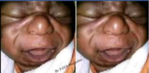 Yajyanye mu nkiko umugore we kubera kubyara umwana ufite isura ‘udashamaje’ asaba impozamarira.INKURU