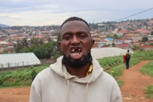 Kigali: Ari gutabaza inzego z’ umutekano nyuma yo gukubitwa n’ abajura amenyo yarishaga inyama yose bayakuramo